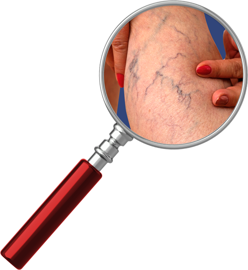 png site