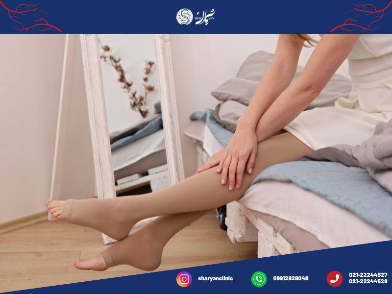 واریس چیست؟|علائم،پیشگیری و درمان آن 3 علل ایجاد واریس