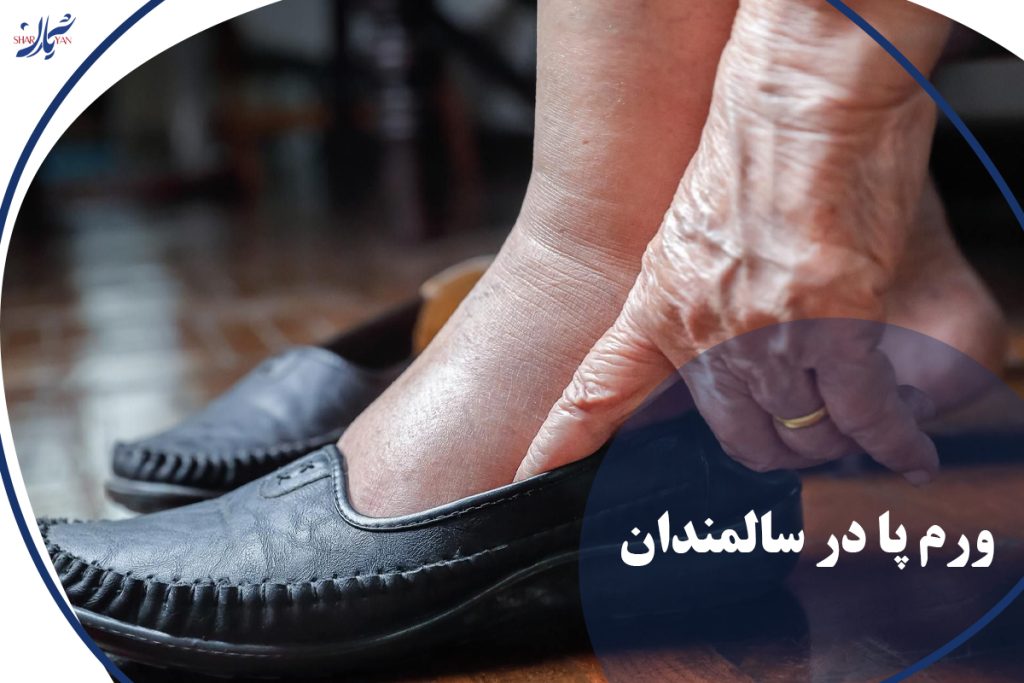 ورم پا در سالمندان