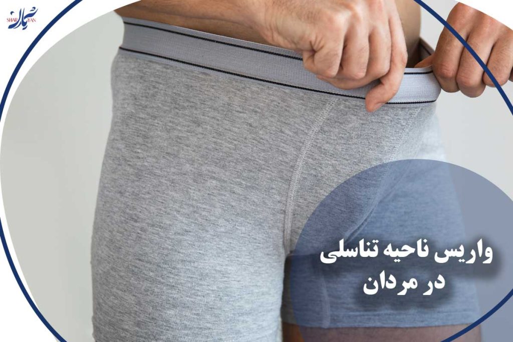 واریس ناحیه تناسلی در مردان