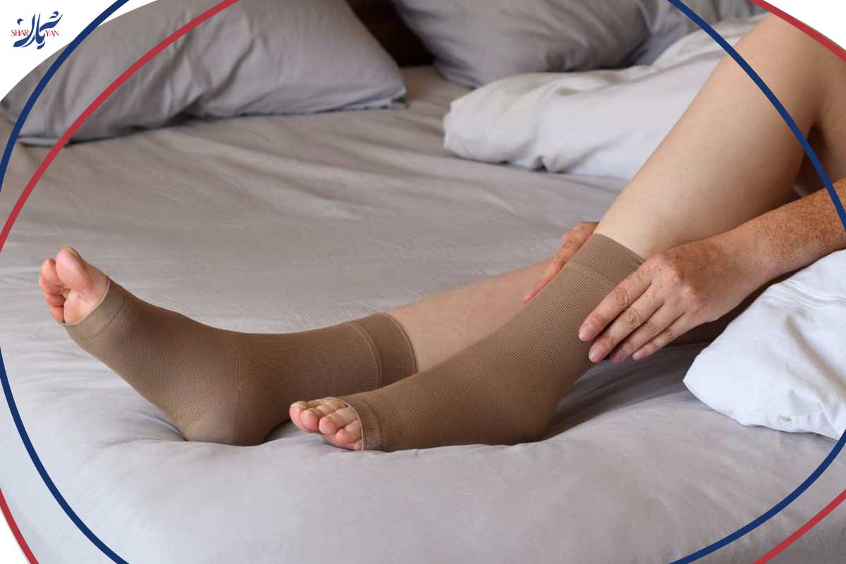 استفاده از فلبکتومی در درمان واریس 5 مراقبتهای پس از فلبکتومی