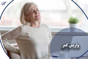 واریس کمر