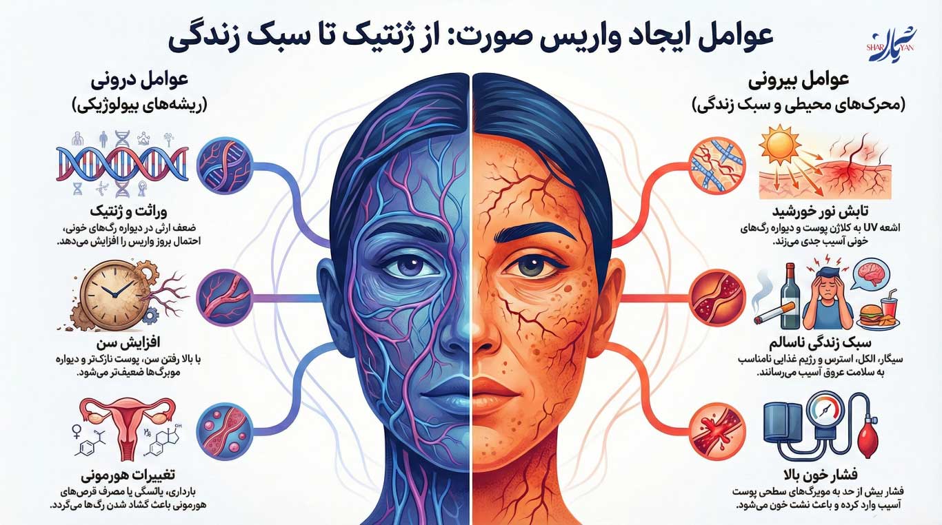 درمان واریس صورت با لیزر در کلینیک شریان 1 علت ایجاد واریس صورت
