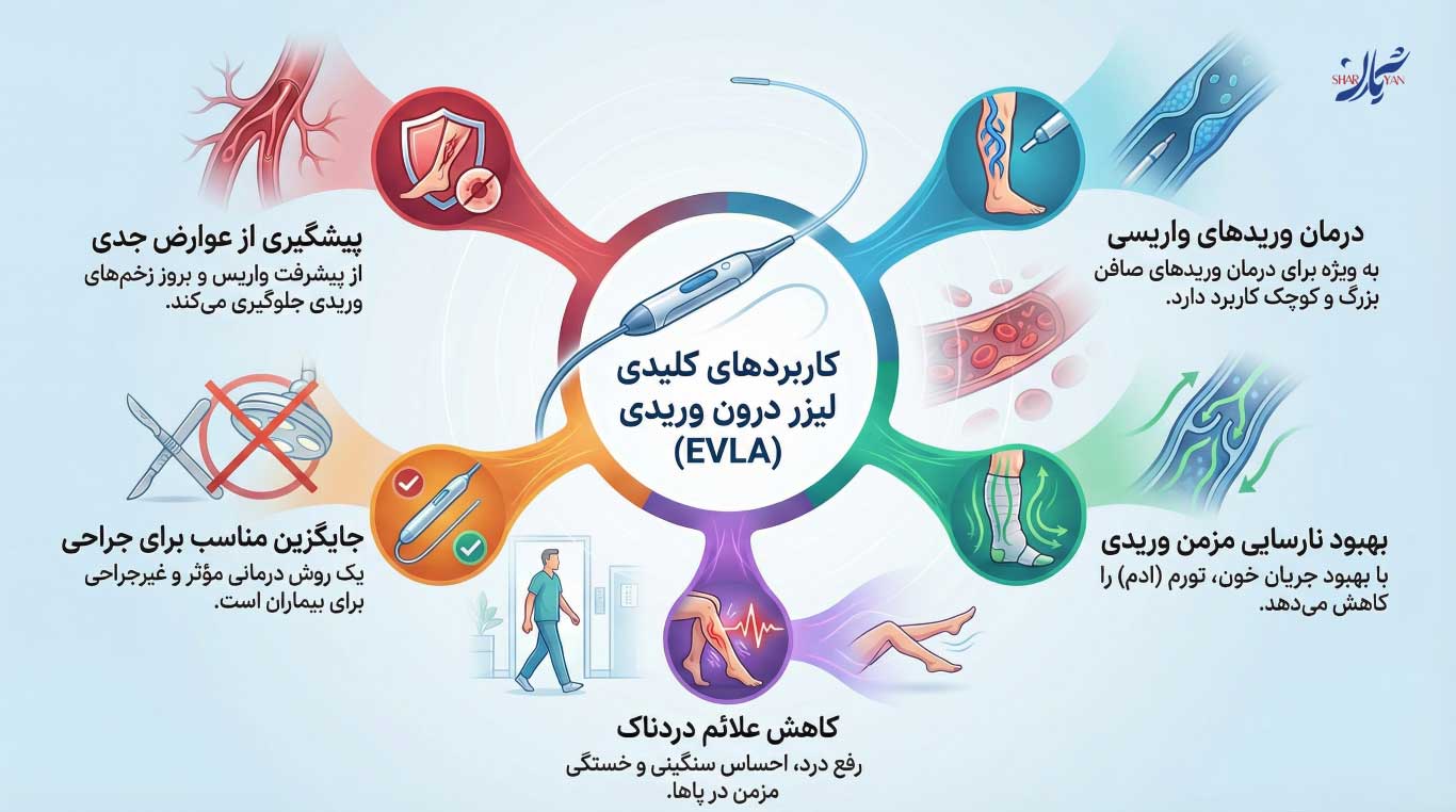 درمان واریس با لیزر درون وریدی EVLA 6 موارد کاربرد لیزر درون وریدی EVLA