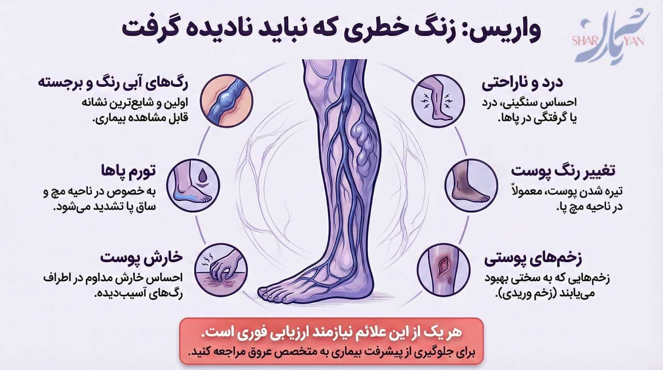 باورهای غلط در رابطه با واریس 5 نشانههای هشدار دهنده واریس که نباید نادیده گرفت