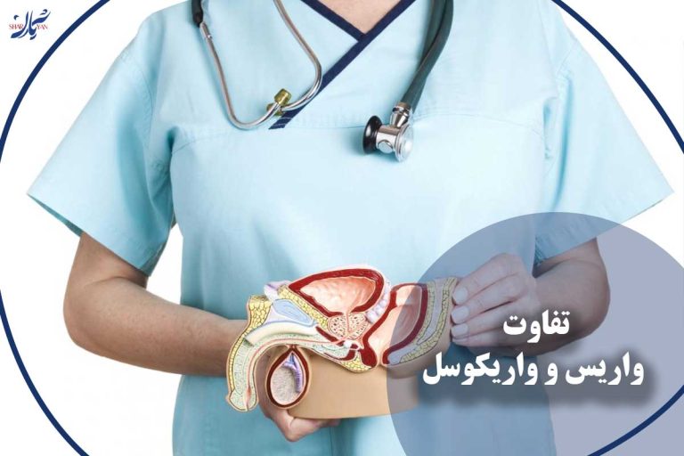 تفاوت واریس و واریکوسل