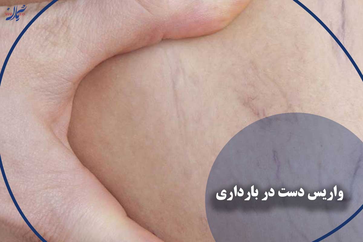 چه زمانی برجستگی رگ‌های دست خطرناک است؟ (علائم هشداردهنده)