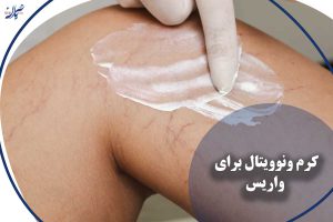 کرم ونوویتال برای واریس
