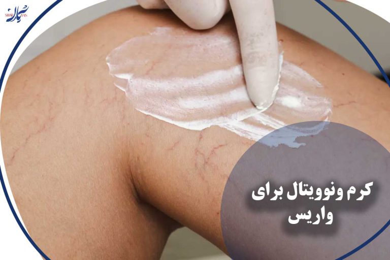 کرم ونوویتال برای واریس