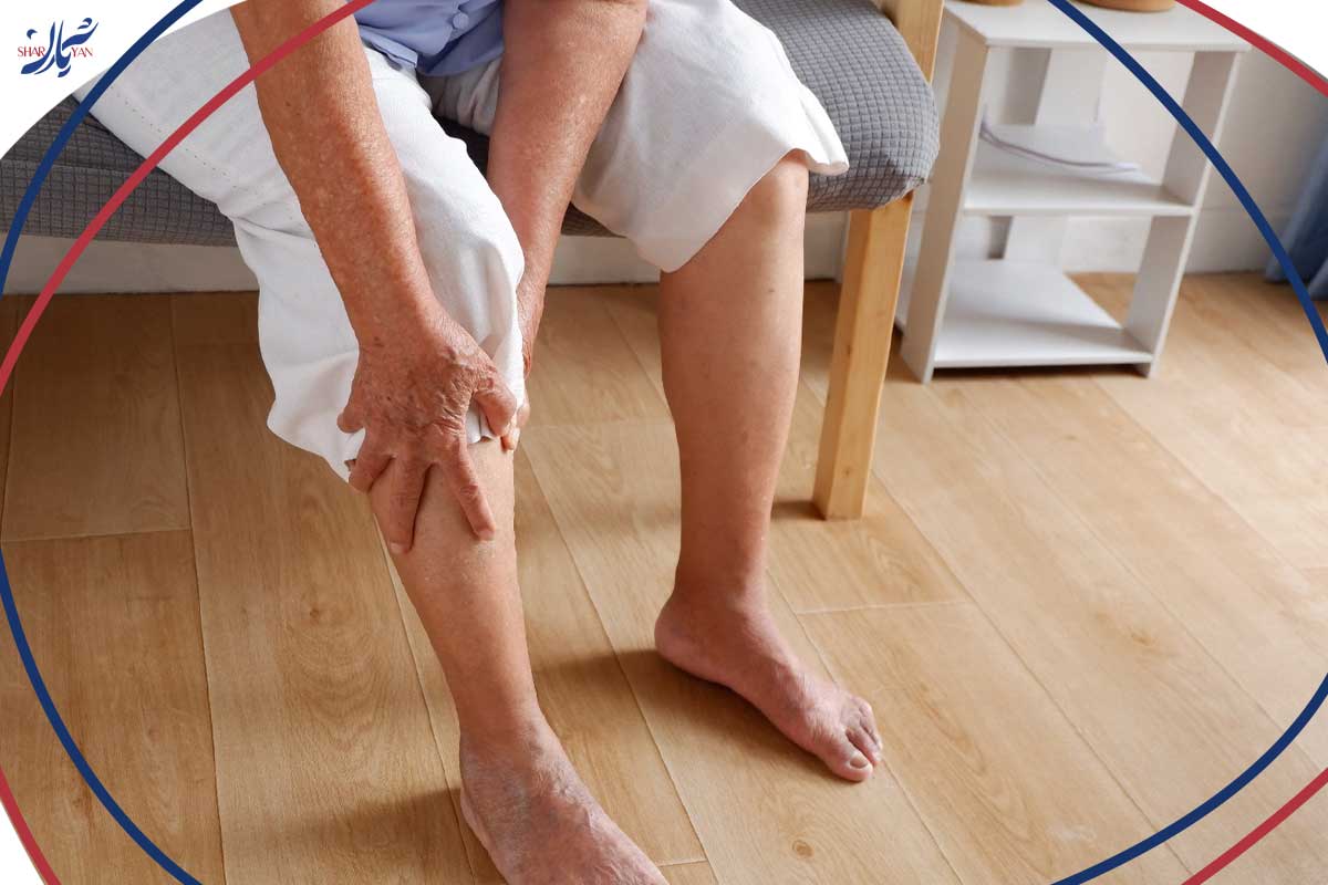 تفاوت واریس و گرفتگی عروق؛ راهنمای کامل شناخت ۲ بیماری عروقی شایع 3 Arterial blockage in an elderly man