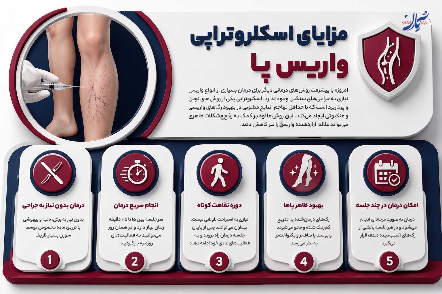 اسکلروتراپی واریس پا چیست و چگونه انجام میشود؟ 1 مزایای اسکلروتراپی واریس پا