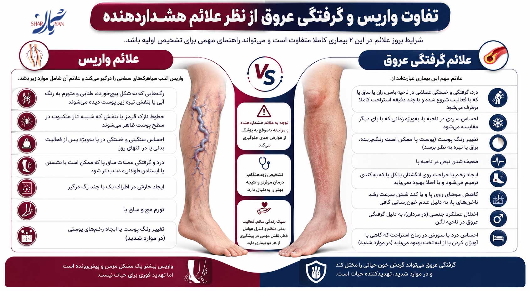 تفاوت واریس و گرفتگی عروق؛ راهنمای کامل شناخت ۲ بیماری عروقی شایع 2 Differences between varicose veins and blocked arteries in terms of warning signs