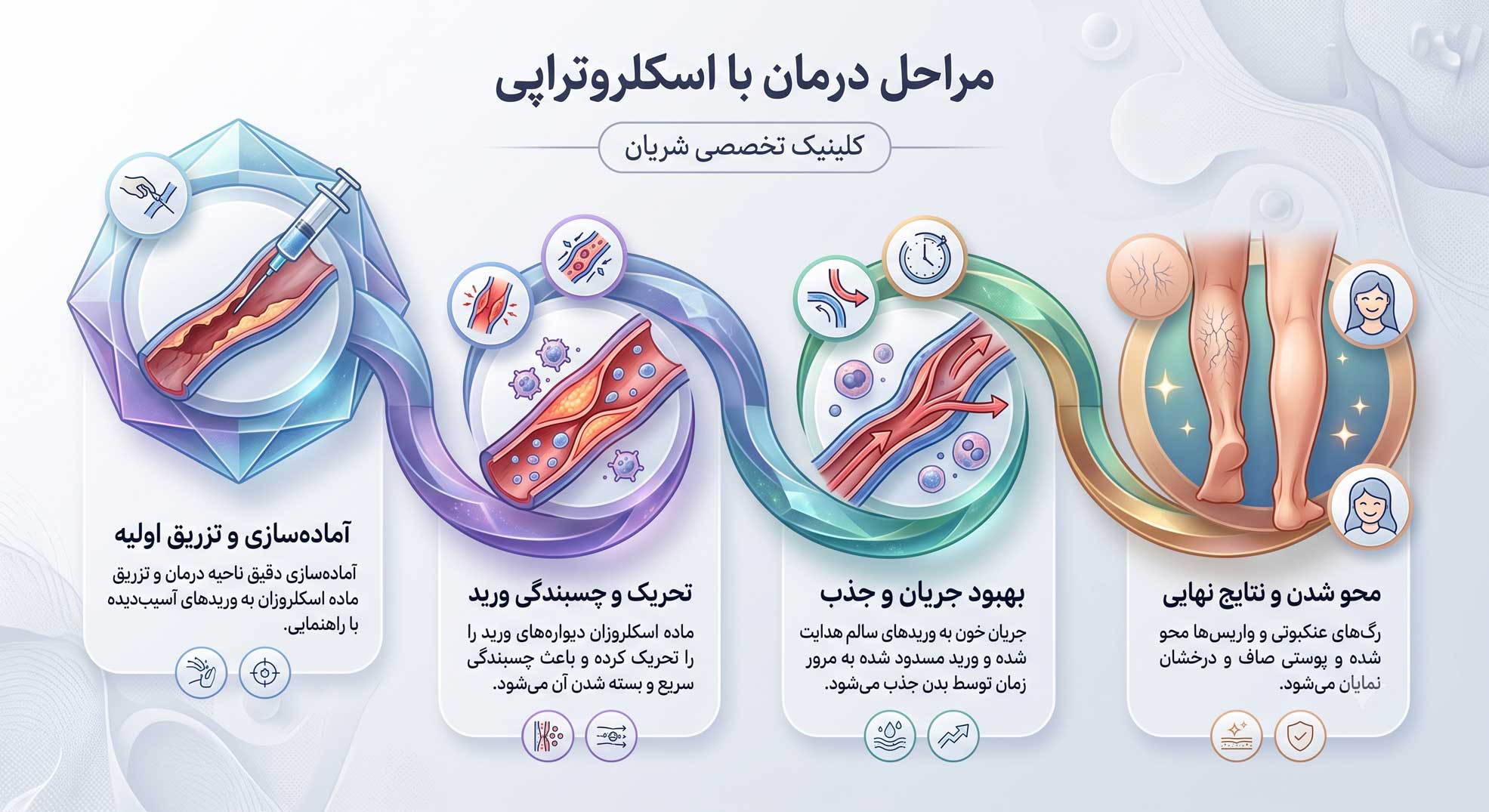اسکلروتراپی؛ درمان مؤثر و غیرجراحی واریس در کلینیک عروقی شریان 3 مراحل انجام اسکلروتراپی
