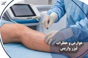 عوارض و خطرات لیزر واریس