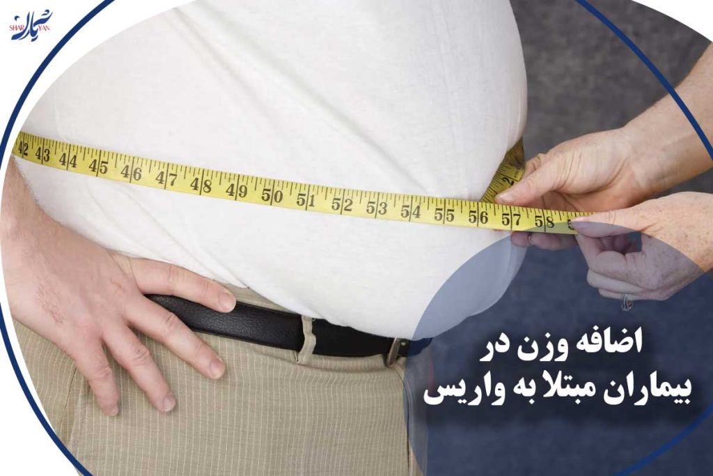 تاثیر چاقی و اضافه وزن بر تشدید واریس پا
