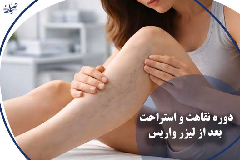 استراحت بعد از لیزر واریس