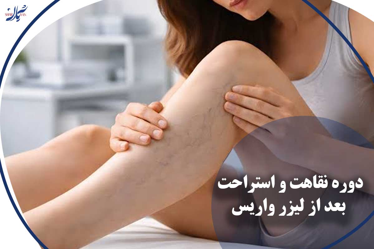 کلینیک شریان|فوق تخصصی ترین کلینیک عروق و واریس 32 استراحت بعد از لیزر واریس