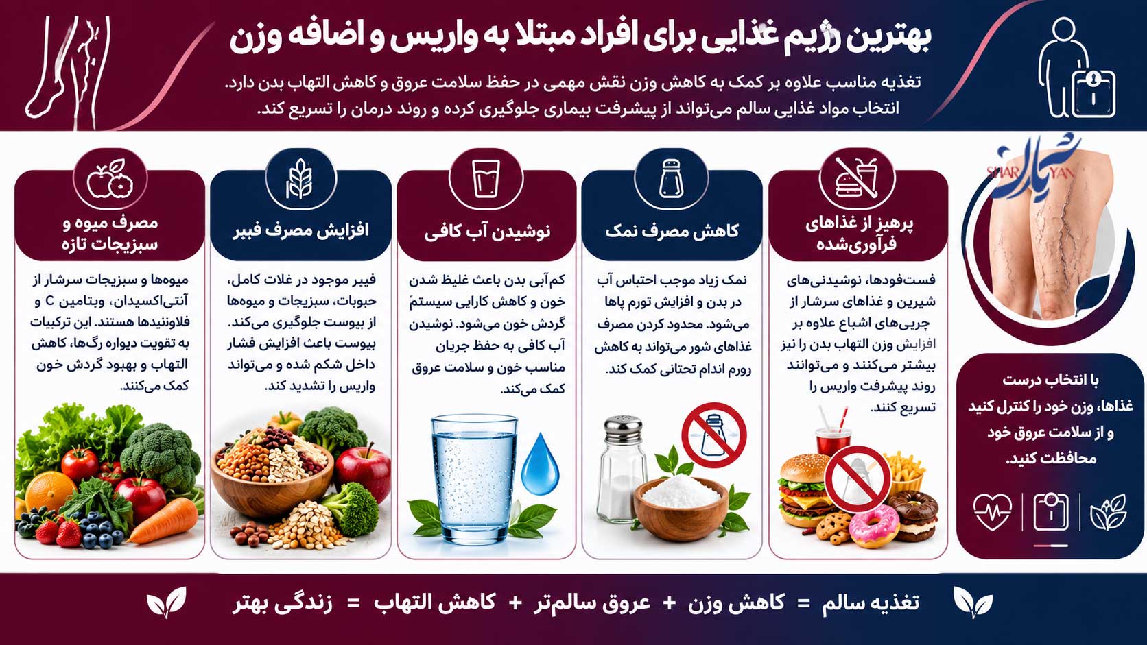 بهترین رژیم غذایی برای افراد مبتلا به واریس و اضافه وزن