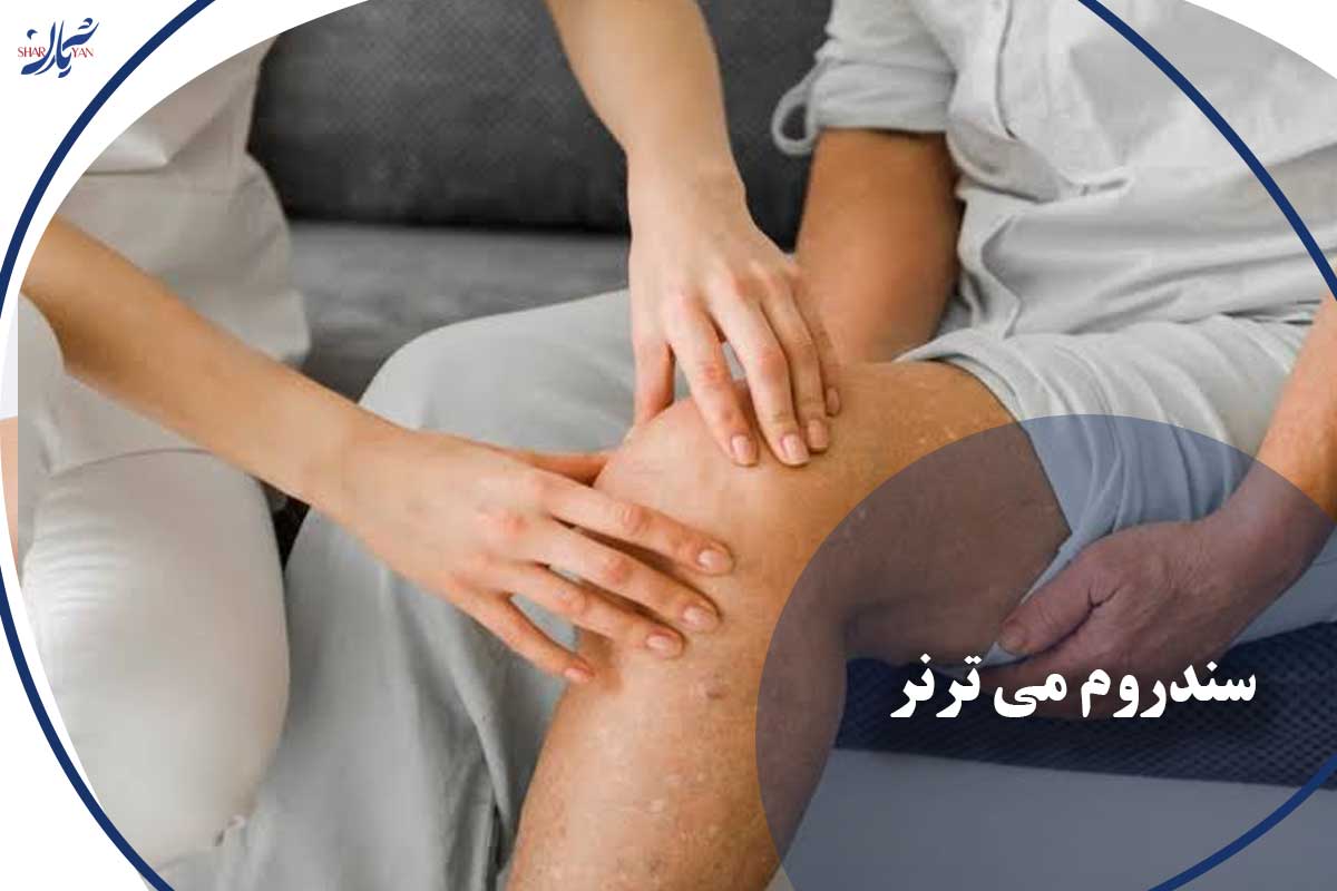 کلینیک شریان|فوق تخصصی ترین کلینیک عروق و واریس 33 سندروم می ترنر