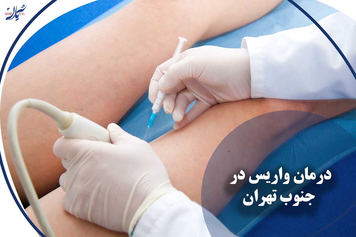 کلینیک شریان|فوق تخصصی ترین کلینیک عروق و واریس 33 درمان واریس در جنوب تهران